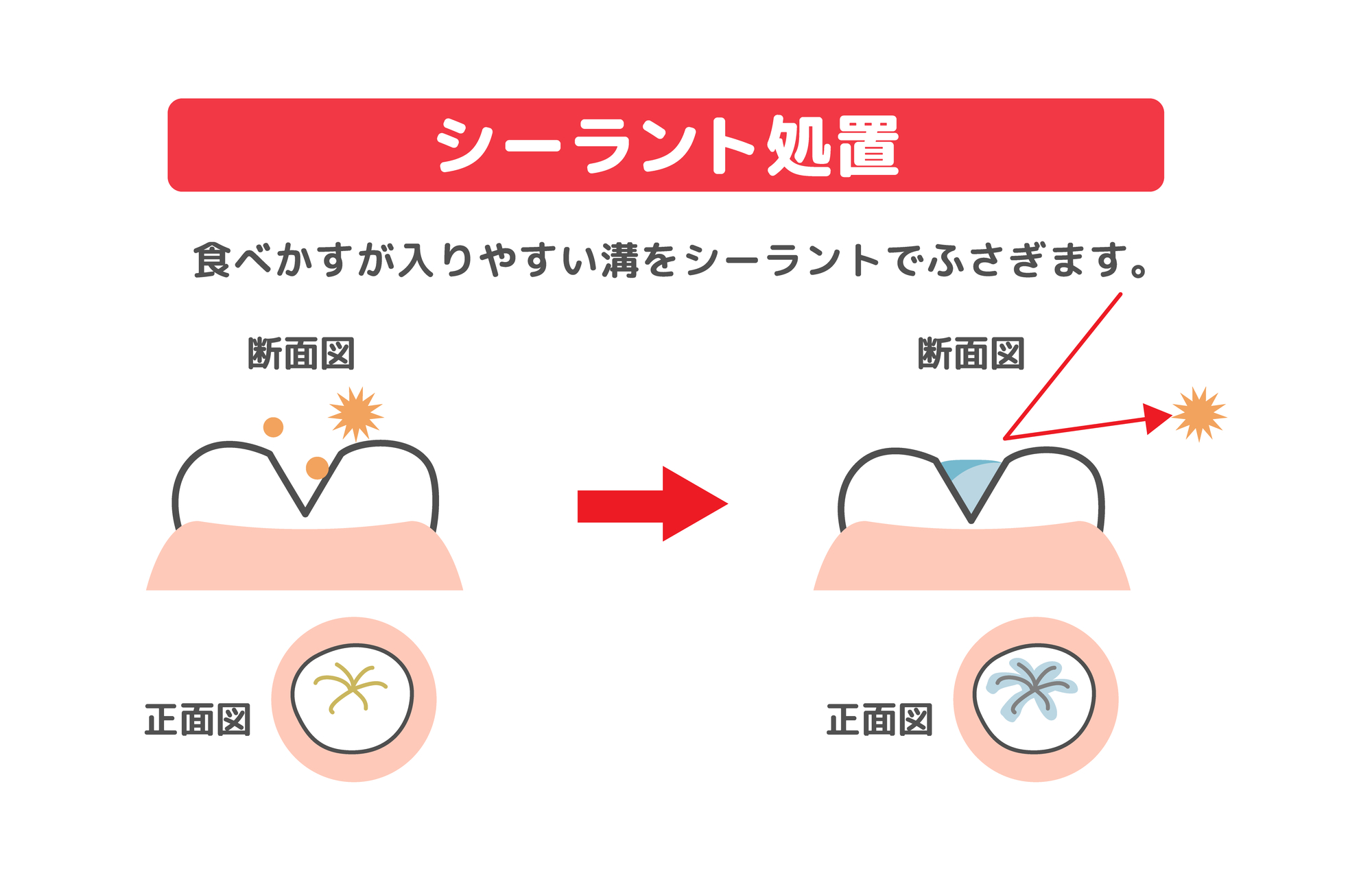 シーラントの解説イラスト